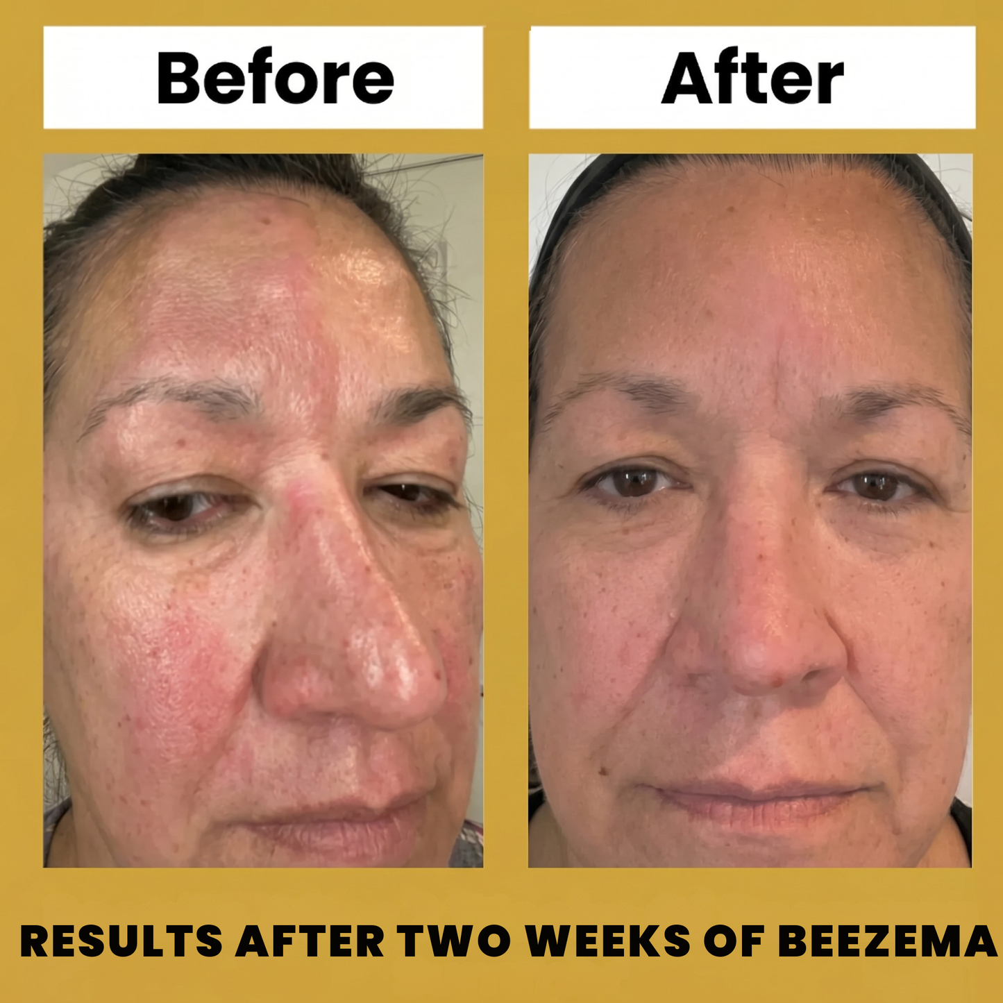 Beezema SD Cream VIP