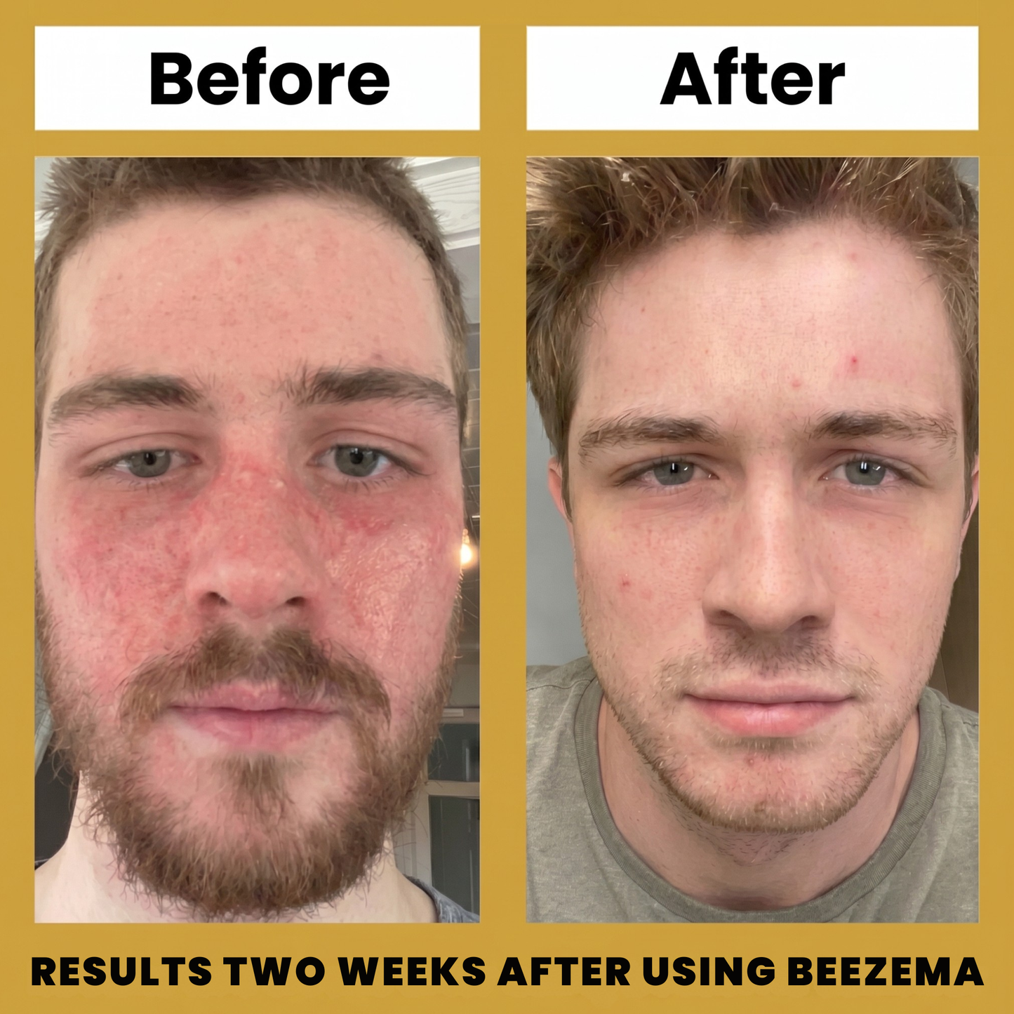 Beezema SD Cream VIP